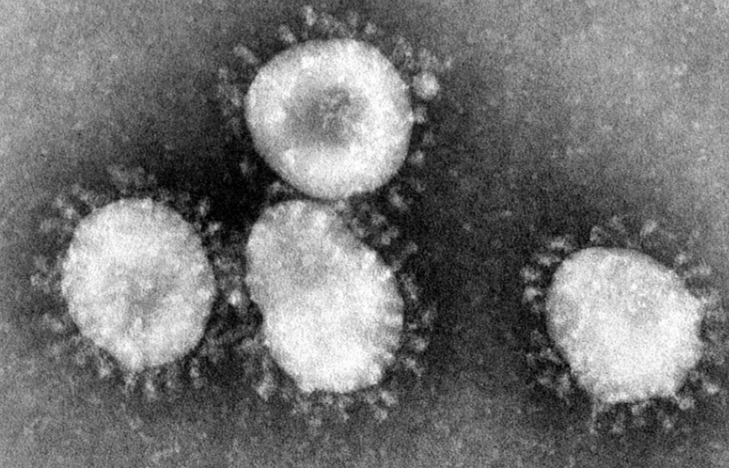 코로나 바이러스 전자현미경 사진(위키피디아)
